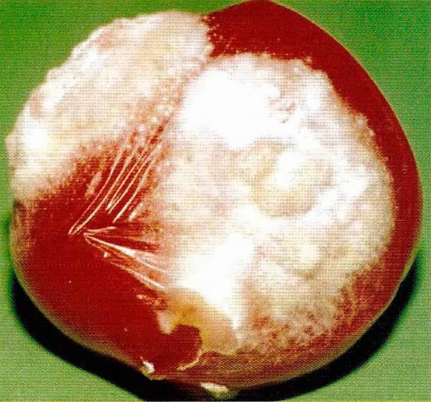 На фото грибковое заболевание белая гниль как еще называют эту болезнь